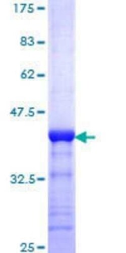 Novus Biologicals Recombinant Human MNAT1 GST (N-Term) Protein 25 &mu;g | Buy Online | Novus Biologicals&trade; | Fisher Scientific