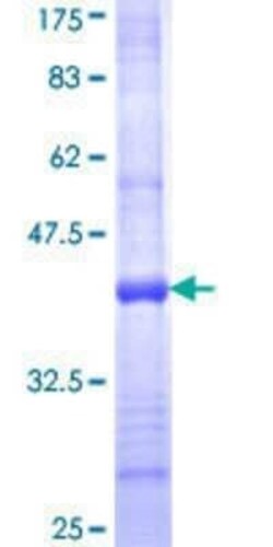 Novus Biologicals Recombinant Human MOS GST (N-Term) Protein 2 &mu;g | Buy Online | Novus Biologicals&trade; | Fisher Scientific
