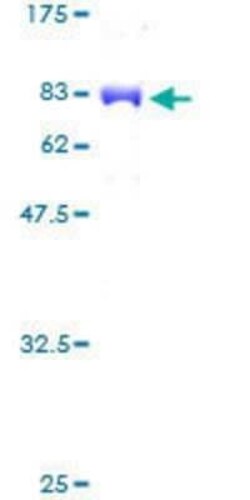 Novus Biologicals Recombinant Human MPP1 GST (N-Term) Protein 10 &mu;g | Buy Online | Novus Biologicals&trade; | Fisher Scientific