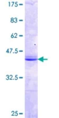 Novus Biologicals Recombinant Human MPP2 GST (N-Term) Protein 10 &mu;g | Buy Online | Novus Biologicals&trade; | Fisher Scientific