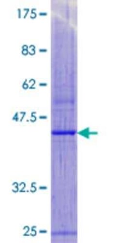 Novus Biologicals&trade;&nbsp;Recombinant Human MPV17 GST (N-Term) Protein