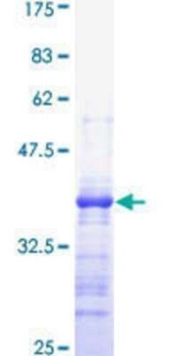 Novus Biologicals Recombinant Human MRP1 GST (N-Term) Protein 10 &mu;g | Buy Online | Novus Biologicals&trade; | Fisher Scientific