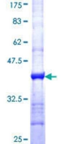 Novus Biologicals Recombinant Human Myosin 1B GST (N-Term) Protein 10 &mu;g | Buy Online | Novus Biologicals&trade; | Fisher Scientific