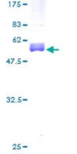 Novus Biologicals Recombinant Human CITED1 GST (N-Term) Protein 2 &mu;g | Buy Online | Novus Biologicals&trade; | Fisher Scientific