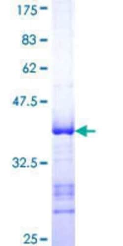 Novus Biologicals Recombinant Human CITED1 GST (N-Term) Protein 25 &mu;g | Buy Online | Novus Biologicals&trade; | Fisher Scientific