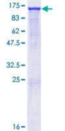 Novus Biologicals Recombinant Human MSH2 GST (N-Term) Protein 10 &mu;g | Buy Online | Novus Biologicals&trade; | Fisher Scientific