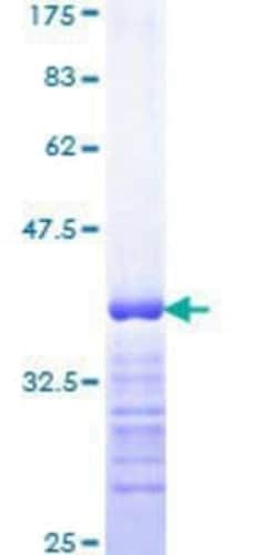 Novus Biologicals Recombinant Human MSH2 GST (N-Term) Protein 25 &mu;g | Buy Online | Novus Biologicals&trade; | Fisher Scientific