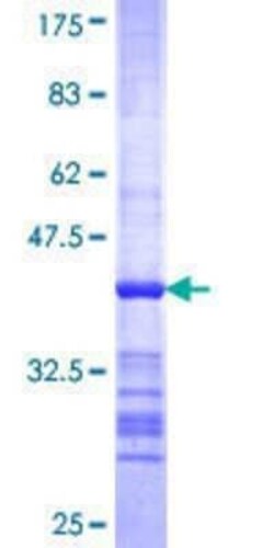 Novus Biologicals Recombinant Human MSH4 GST (N-Term) Protein 10 &mu;g | Buy Online | Novus Biologicals&trade; | Fisher Scientific