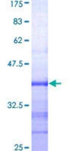 Novus Biologicals Recombinant Human MSH5 GST (N-Term) Protein 25 &mu;g | Buy Online | Novus Biologicals&trade; | Fisher Scientific