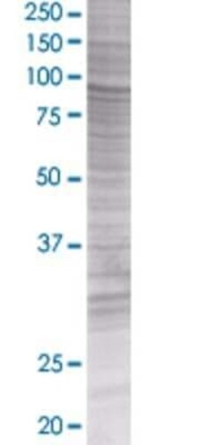 Novus Biologicals MSP/MST1 293T Cell Transient Overexpression Lysate 0.1 mL | Buy Online | Novus Biologicals&trade; | Fisher Scientific