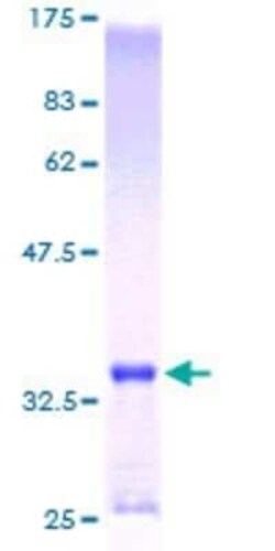 Novus Biologicals Recombinant Human Metallothionein-1E GST (N-Term) Protein 25 &mu;g | Buy Online | Novus Biologicals&trade; | Fisher Scientific