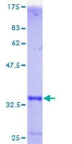 Novus Biologicals Recombinant Human Metallothionein-1F GST (N-Term) Protein 10 &mu;g | Buy Online | Novus Biologicals&trade; | Fisher Scientific