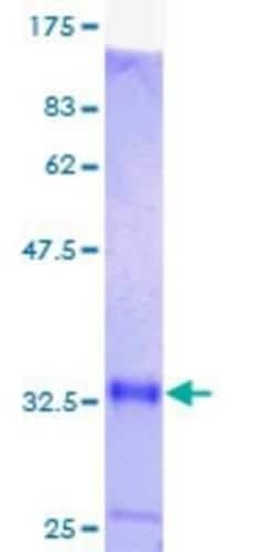 Novus Biologicals Recombinant Human Metallothionein-1M GST (N-Term) Protein 10 &mu;g | Buy Online | Novus Biologicals&trade; | Fisher Scientific