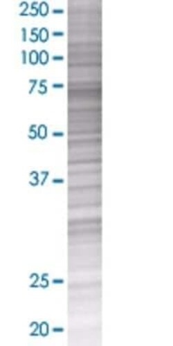 Novus Biologicals MTHFR 293T Cell Transient Overexpression Lysate 0.1 mL | Buy Online | Novus Biologicals&trade; | Fisher Scientific