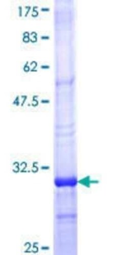 Novus Biologicals Recombinant Human MT-ND4 GST (N-Term) Protein 25 &mu;g | Buy Online | Novus Biologicals&trade; | Fisher Scientific