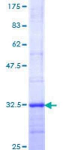 Novus Biologicals Recombinant Human Melatonin R1A/MT1/MTNR1A GST (N-Term) Protein 25 &mu;g | Buy Online | Novus Biologicals&trade; | Fisher Scientific