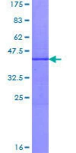 Novus Biologicals Recombinant Human MTTP GST (N-Term) Protein 25 &mu;g | Buy Online | Novus Biologicals&trade; | Fisher Scientific
