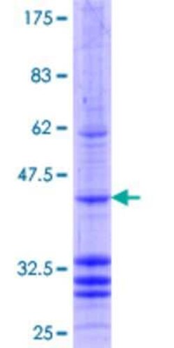 Novus Biologicals Recombinant Human MTTP GST (N-Term) Protein 25 &mu;g | Buy Online | Novus Biologicals&trade; | Fisher Scientific