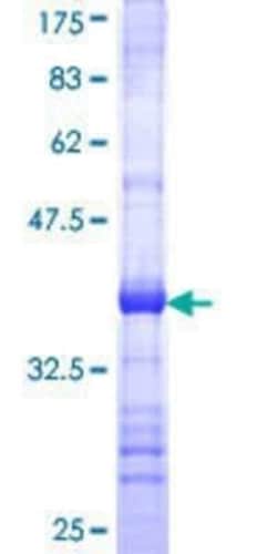 Novus Biologicals Recombinant Human MTRR GST (N-Term) Protein 10 &mu;g | Buy Online | Novus Biologicals&trade; | Fisher Scientific