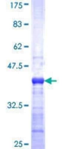 Novus Biologicals Recombinant Human MUC7 GST (N-Term) Protein 10 &mu;g | Buy Online | Novus Biologicals&trade; | Fisher Scientific