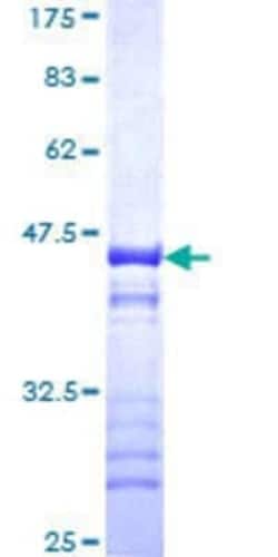 Novus Biologicals Recombinant Human TRIM37 GST (N-Term) Protein 10 &mu;g | Buy Online | Novus Biologicals&trade; | Fisher Scientific