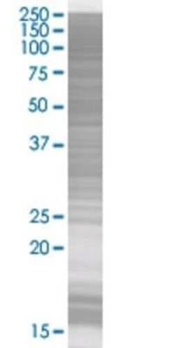 Novus Biologicals MX2 293T Cell Transient Overexpression Lysate 0.1 mL | Buy Online | Novus Biologicals&trade; | Fisher Scientific