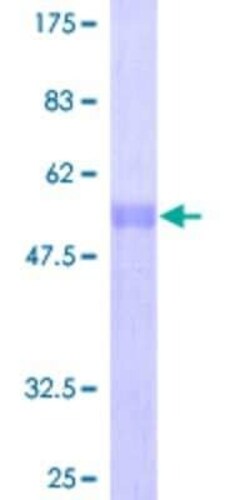 Novus Biologicals Recombinant Human Mxi1 GST (N-Term) Protein 10 &mu;g | Buy Online | Novus Biologicals&trade; | Fisher Scientific