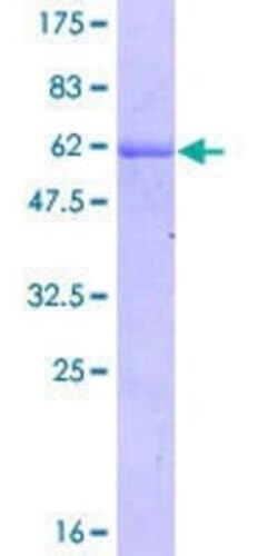 Novus Biologicals Recombinant Human Mxi1 GST (N-Term) Protein 25 &mu;g | Buy Online | Novus Biologicals&trade; | Fisher Scientific