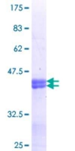 Novus Biologicals Recombinant Human Mxi1 GST (N-Term) Protein 25 &mu;g | Buy Online | Novus Biologicals&trade; | Fisher Scientific