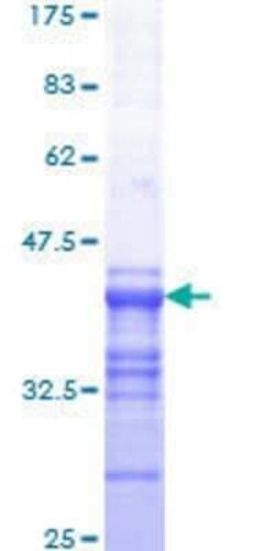 Novus Biologicals Recombinant Human c-Myb GST (N-Term) Protein 10 &mu;g | Buy Online | Novus Biologicals&trade; | Fisher Scientific