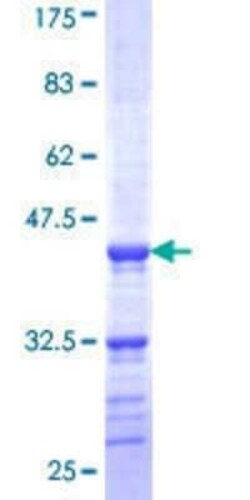 Novus Biologicals Recombinant Human A-Myb GST (N-Term) Protein 10 &mu;g | Buy Online | Novus Biologicals&trade; | Fisher Scientific