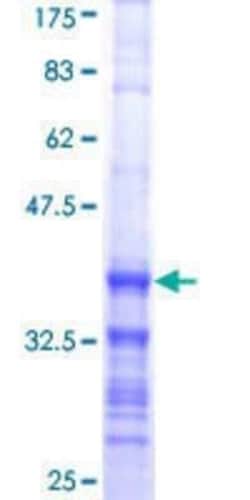 Novus Biologicals Recombinant Human B-Myb GST (N-Term) Protein 25 &mu;g | Buy Online | Novus Biologicals&trade; | Fisher Scientific