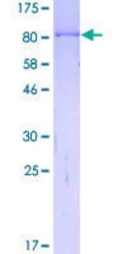 Novus Biologicals Recombinant Human MYBPH GST (N-Term) Protein 10 &mu;g | Buy Online | Novus Biologicals&trade; | Fisher Scientific