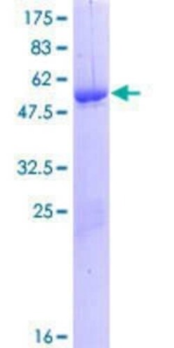Novus Biologicals Recombinant Human MYF6 GST (N-Term) Protein 25 &mu;g | Buy Online | Novus Biologicals&trade; | Fisher Scientific
