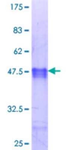 Novus Biologicals Recombinant Human MYF6 GST (N-Term) Protein 10 &mu;g | Buy Online | Novus Biologicals&trade; | Fisher Scientific