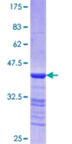 Novus Biologicals Recombinant Human Myosin Heavy Chain 3 GST (N-Term) Protein 25 &mu;g | Buy Online | Novus Biologicals&trade; | Fisher Scientific