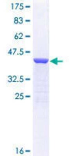 Novus Biologicals Recombinant Human MYH7 GST (N-Term) Protein 25 &mu;g | Buy Online | Novus Biologicals&trade; | Fisher Scientific
