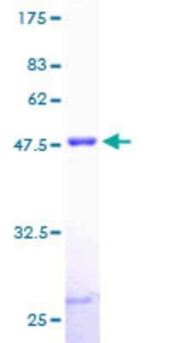 Novus Biologicals Recombinant Human Myosin light chain 3 GST (N-Term) Protein 10 &mu;g | Buy Online | Novus Biologicals&trade; | Fisher Scientific