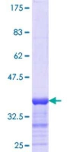 Novus Biologicals Recombinant Human Myosin light chain 3 GST (N-Term) Protein 25 &mu;g | Buy Online | Novus Biologicals&trade; | Fisher Scientific