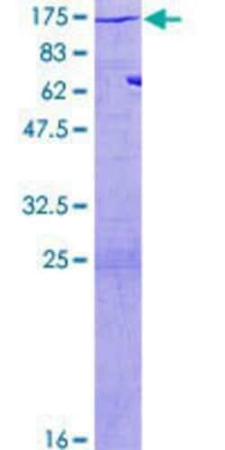 Novus Biologicals Recombinant Human Myosin light chain kinase GST (N-Term) Protein 2 &mu;g | Buy Online | Novus Biologicals&trade; | Fisher Scientific
