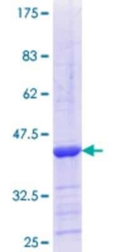 Novus Biologicals Recombinant Human Myosin 1C GST (N-Term) Protein 25 &mu;g | Buy Online | Novus Biologicals&trade; | Fisher Scientific