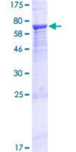 Novus Biologicals Recombinant Human Myosin-Id GST (N-Term) Protein 25 &mu;g | Buy Online | Novus Biologicals&trade; | Fisher Scientific