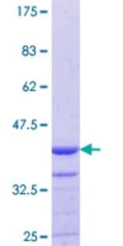 Novus Biologicals Recombinant Human Myosin 1E GST (N-Term) Protein 10 &mu;g | Buy Online | Novus Biologicals&trade; | Fisher Scientific