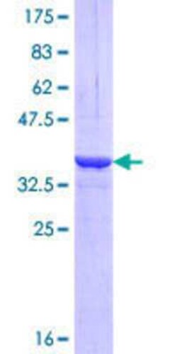 Novus Biologicals Recombinant Human MYO6 GST (N-Term) Protein 25 &mu;g | Buy Online | Novus Biologicals&trade; | Fisher Scientific