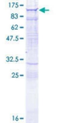 Novus Biologicals Recombinant Human Myosin IXA GST (N-Term) Protein 25 &mu;g | Buy Online | Novus Biologicals&trade; | Fisher Scientific