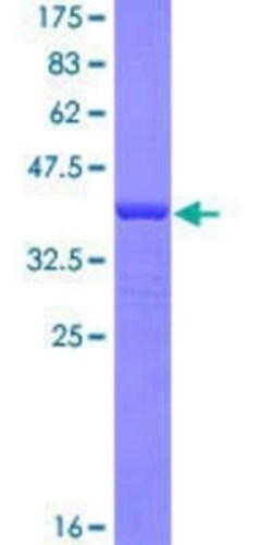 Novus Biologicals Recombinant Human Myosin IXA GST (N-Term) Protein 10 &mu;g | Buy Online | Novus Biologicals&trade; | Fisher Scientific