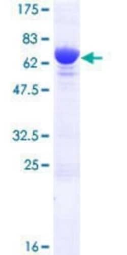 Novus Biologicals Recombinant Human Myosin Phosphatase 2 GST (N-Term) Protein 10 &mu;g | Buy Online | Novus Biologicals&trade; | Fisher Scientific