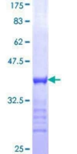 Novus Biologicals Recombinant Human Myt1 GST (N-Term) Protein 10 &mu;g | Buy Online | Novus Biologicals&trade; | Fisher Scientific