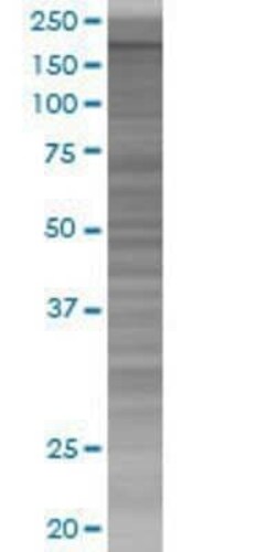 Novus Biologicals Myt1 293T Cell Transient Overexpression Lysate 0.1 mL | Buy Online | Novus Biologicals&trade; | Fisher Scientific