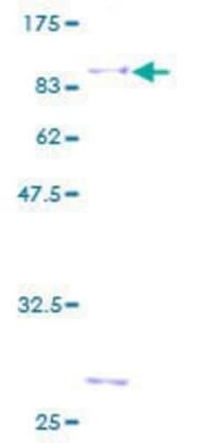 Novus Biologicals Recombinant Human NAB1 GST (N-Term) Protein 25 &mu;g | Buy Online | Novus Biologicals&trade; | Fisher Scientific